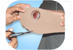 Ulcer Management Insole